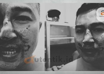 Kondisi Taufik Nur, korban dugaan penganiayaan oleh oknum anggota Polri, Kamis (18/4/2024).