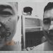 Kondisi Taufik Nur, korban dugaan penganiayaan oleh oknum anggota Polri, Kamis (18/4/2024).