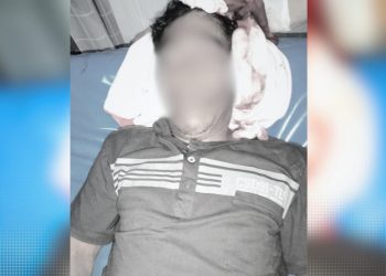 Ruslin korban penganiayaan di Kecamatan Lemito, Kabupaten Pohuwato.