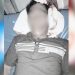 Ruslin korban penganiayaan di Kecamatan Lemito, Kabupaten Pohuwato.